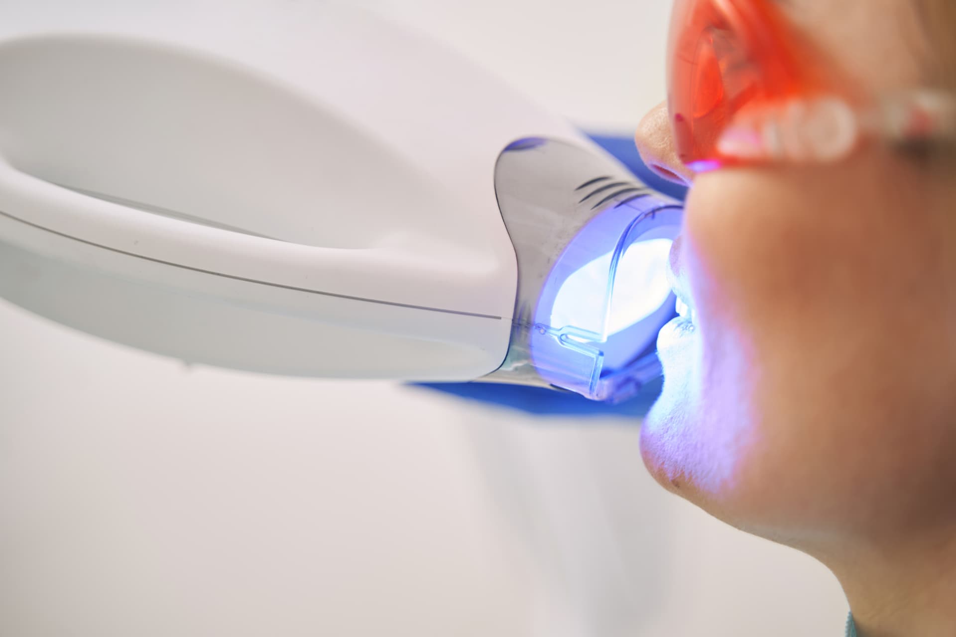 Estética dental